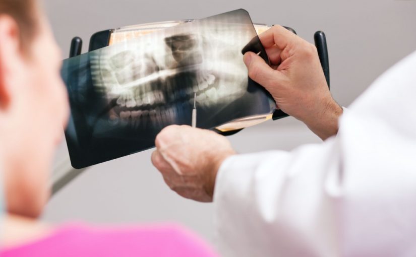 Digital X-Rays and Safety Information