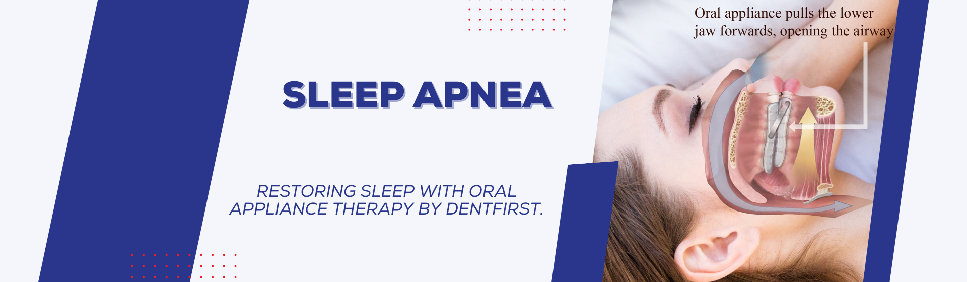 SLEEP APNEA