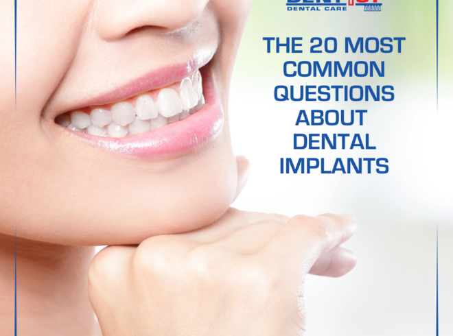 20 most common questions about dental implants