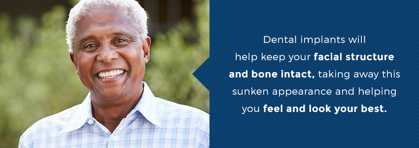Dental Implants Alpharetta