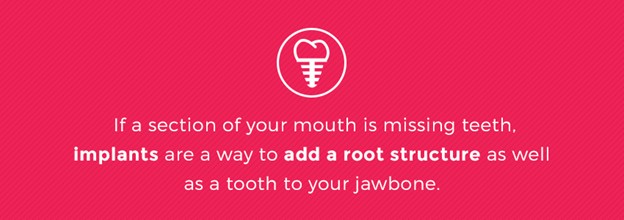 Mouth Missing